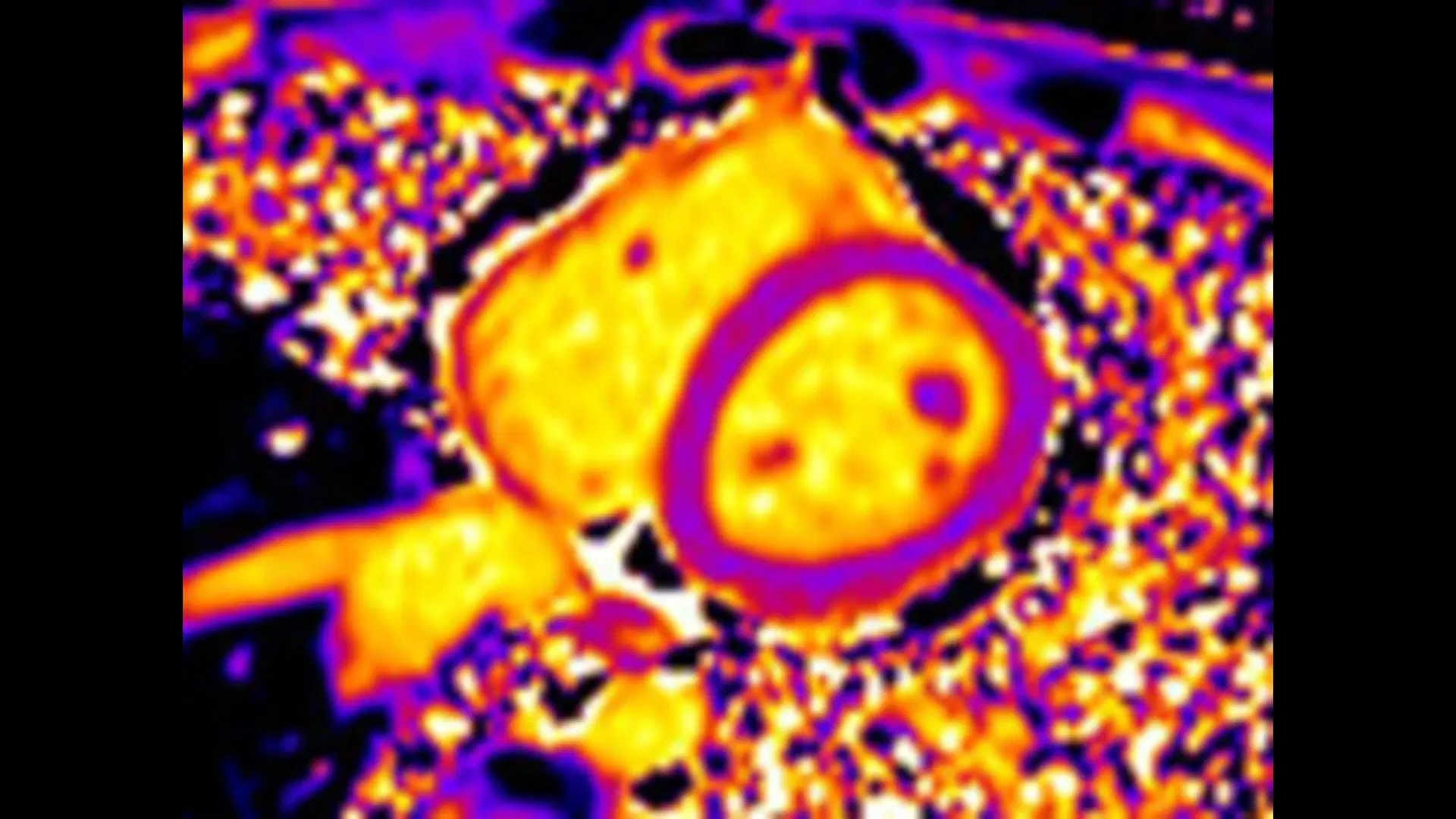 Кардиология