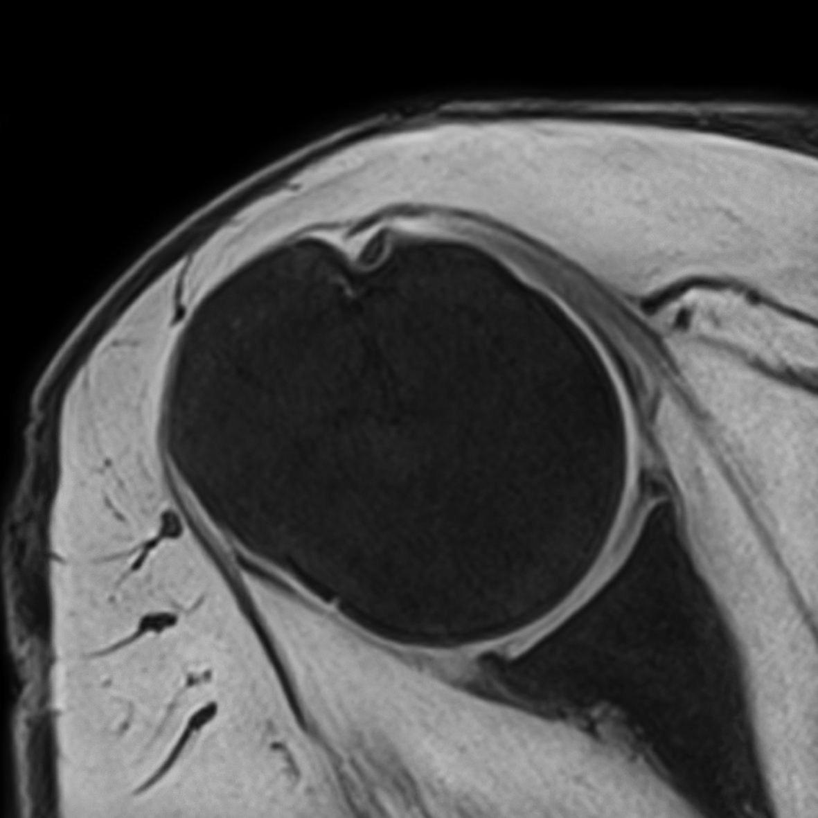 Катушка для плеча Siemens Shoulder Large 16, Shoulder Small 16