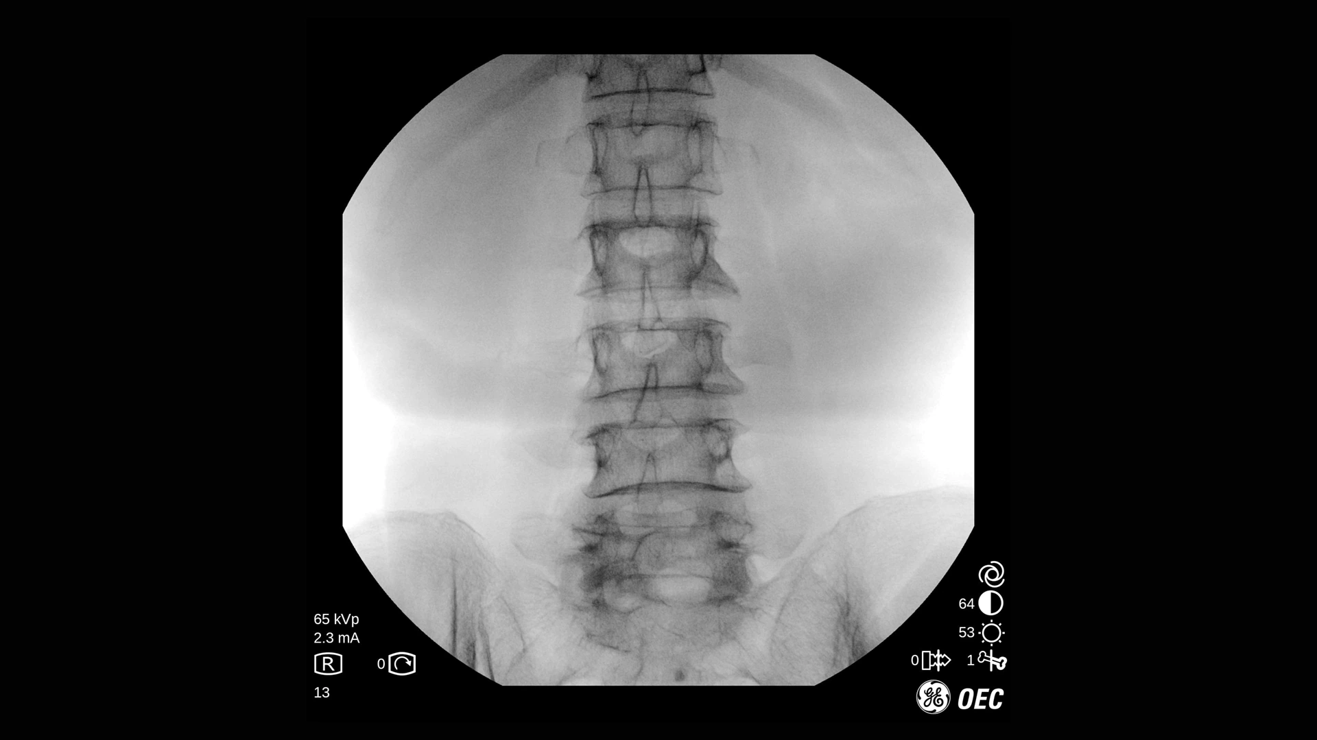 Мобильный рентгеновский аппарат с С-дугой GE OEC One CFD