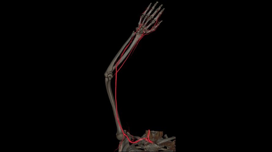 Компьютерный томограф GE Revolution Maxima