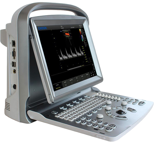 УЗИ аппарат Chison SonoTouch 50
