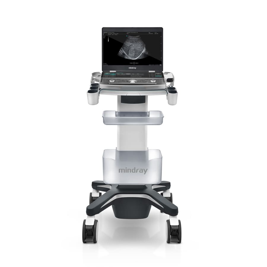 Портативный УЗИ аппарат Mindray MX8 Exp