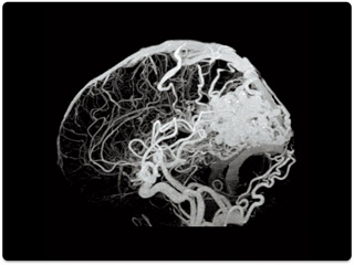 Компьютерный томограф Canon Aquilion RXL