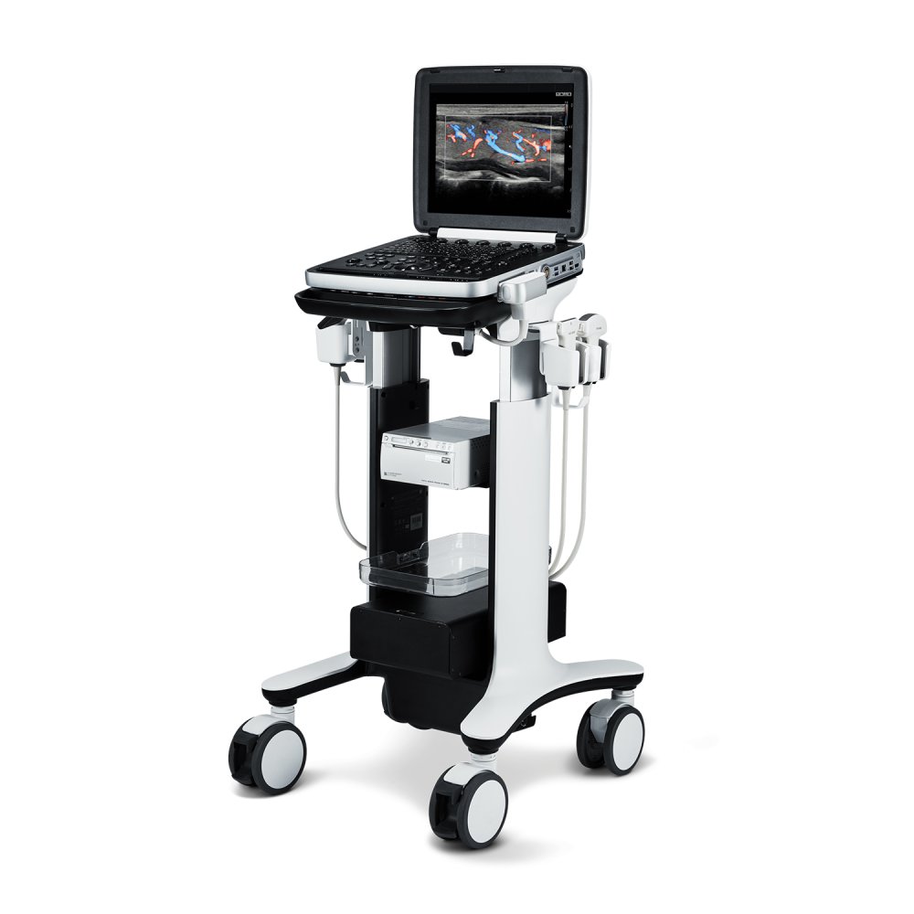 УЗИ аппарат РуСкан 70П