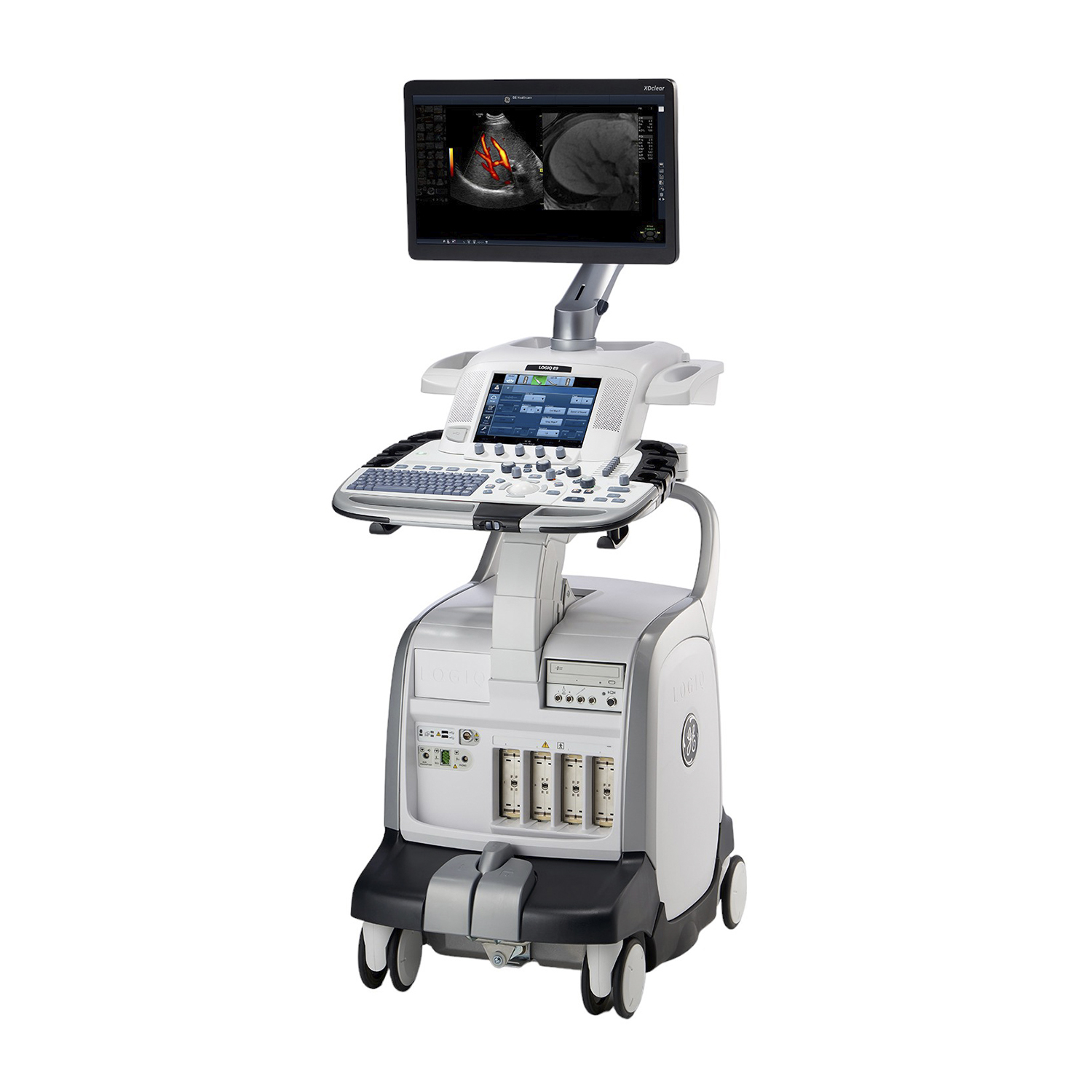 Ультразвуковая диагностическая система GE Healthcare LOGIQ E9 XDclear