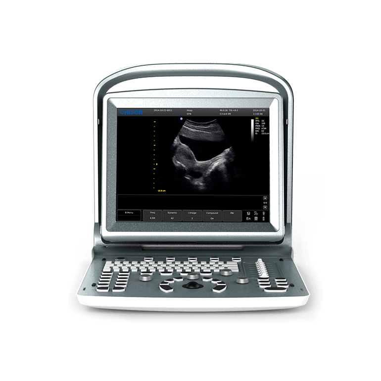 УЗИ аппарат CHISON ECO 5