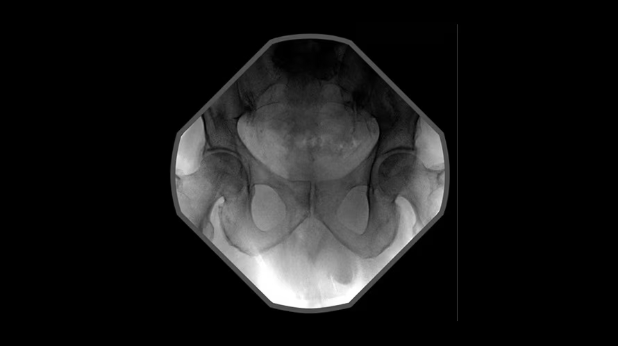 Мобильный рентгеновский аппарат с С-дугой GE OEC Elite CFD