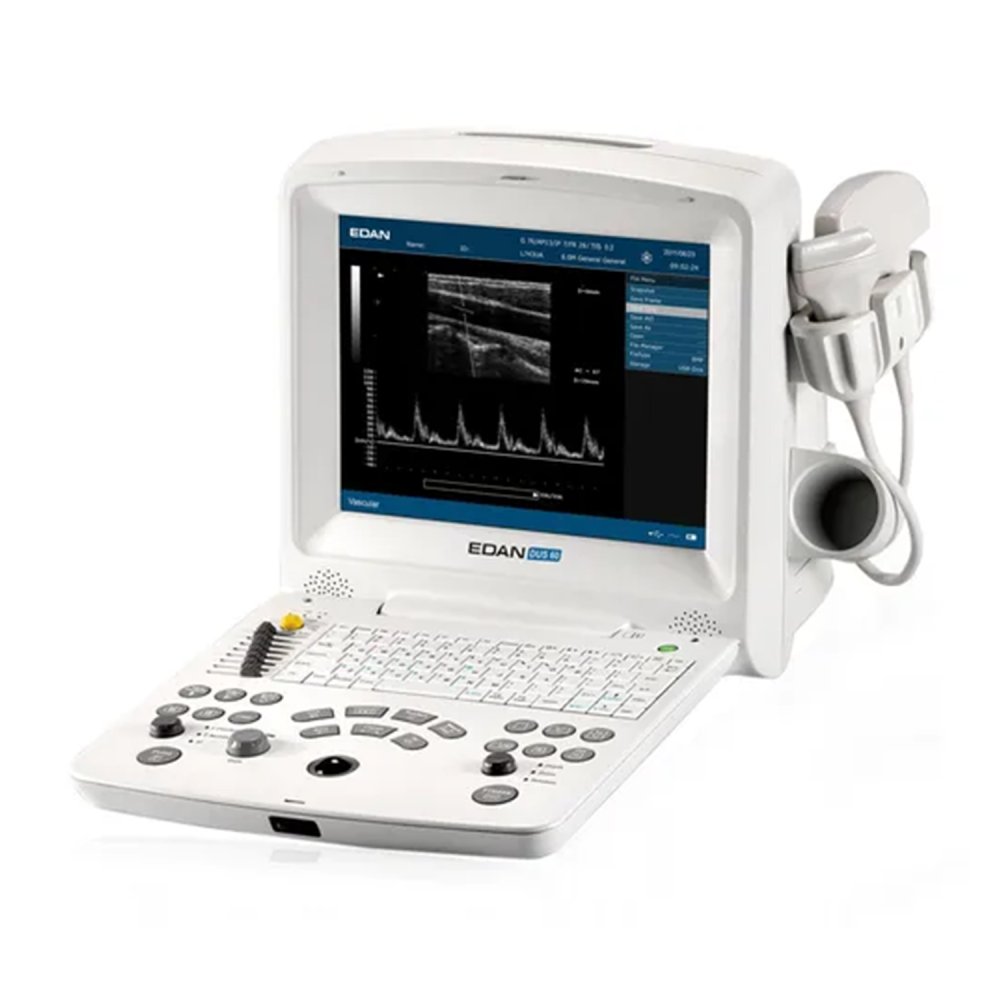 Аппарат УЗИ Edan Dus 60