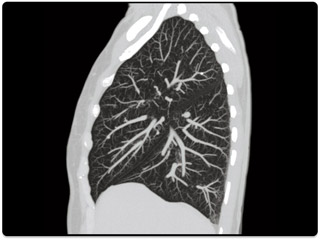 Компьютерный томограф Canon Aquilion RXL