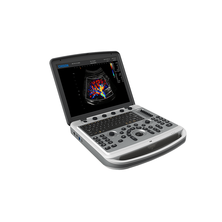 УЗИ аппарат Chison SonoTouch 80 (SonoBook 6)
