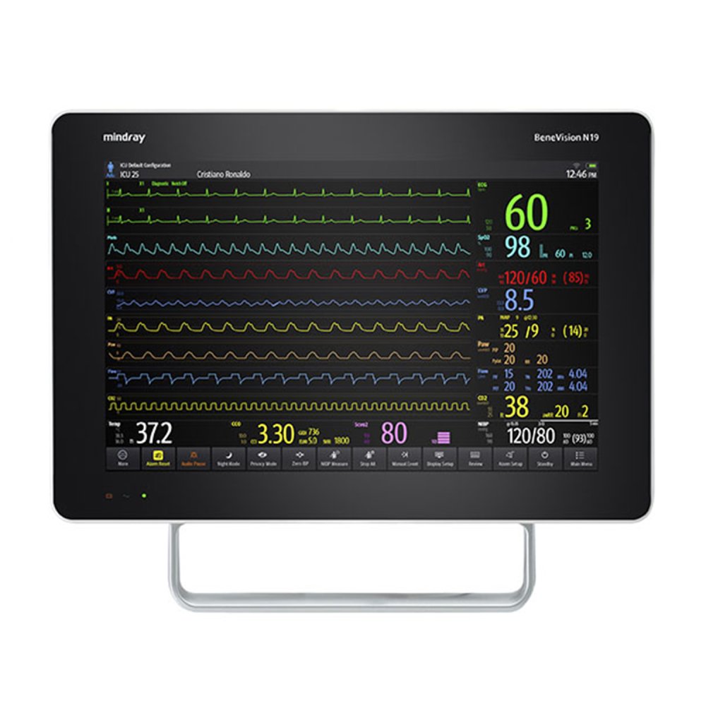 Монитор пациента Mindray BeneVision N19