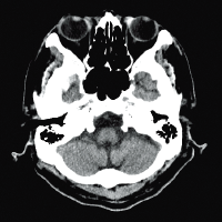 Компьютерный томограф Fujifilm Supria 128