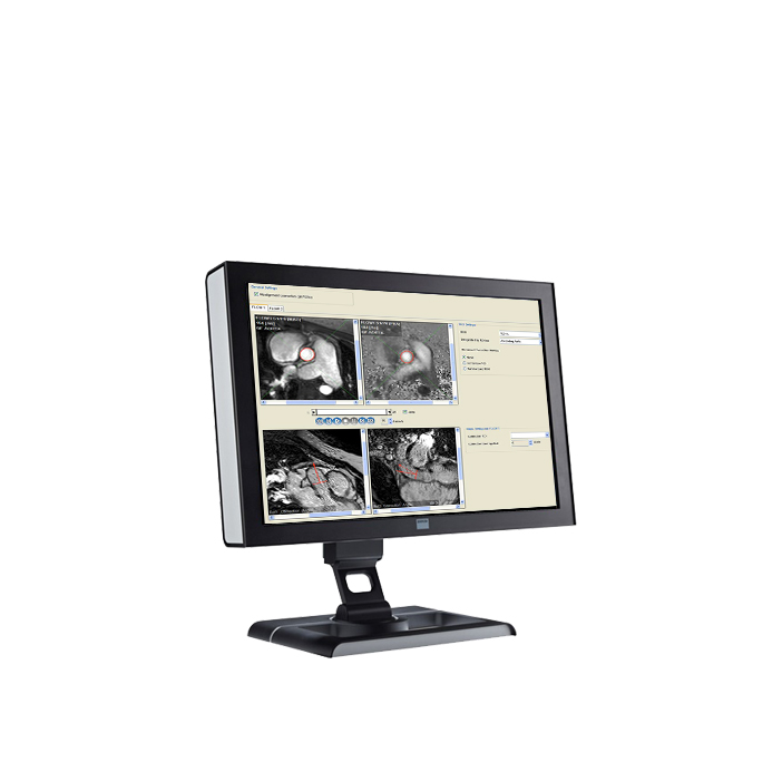 ПО для магнитно-резонансного анализа кровотока Esaote CAAS MR Flow