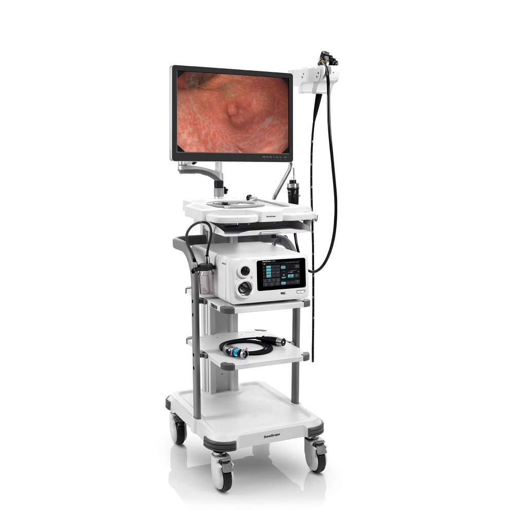 Эндоскопическая ветеринарная видеосистема SonoScape V2000