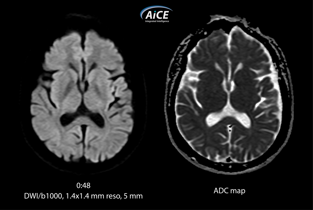 Магнитно-резонансный томограф Canon Vantage Elan 1.5T