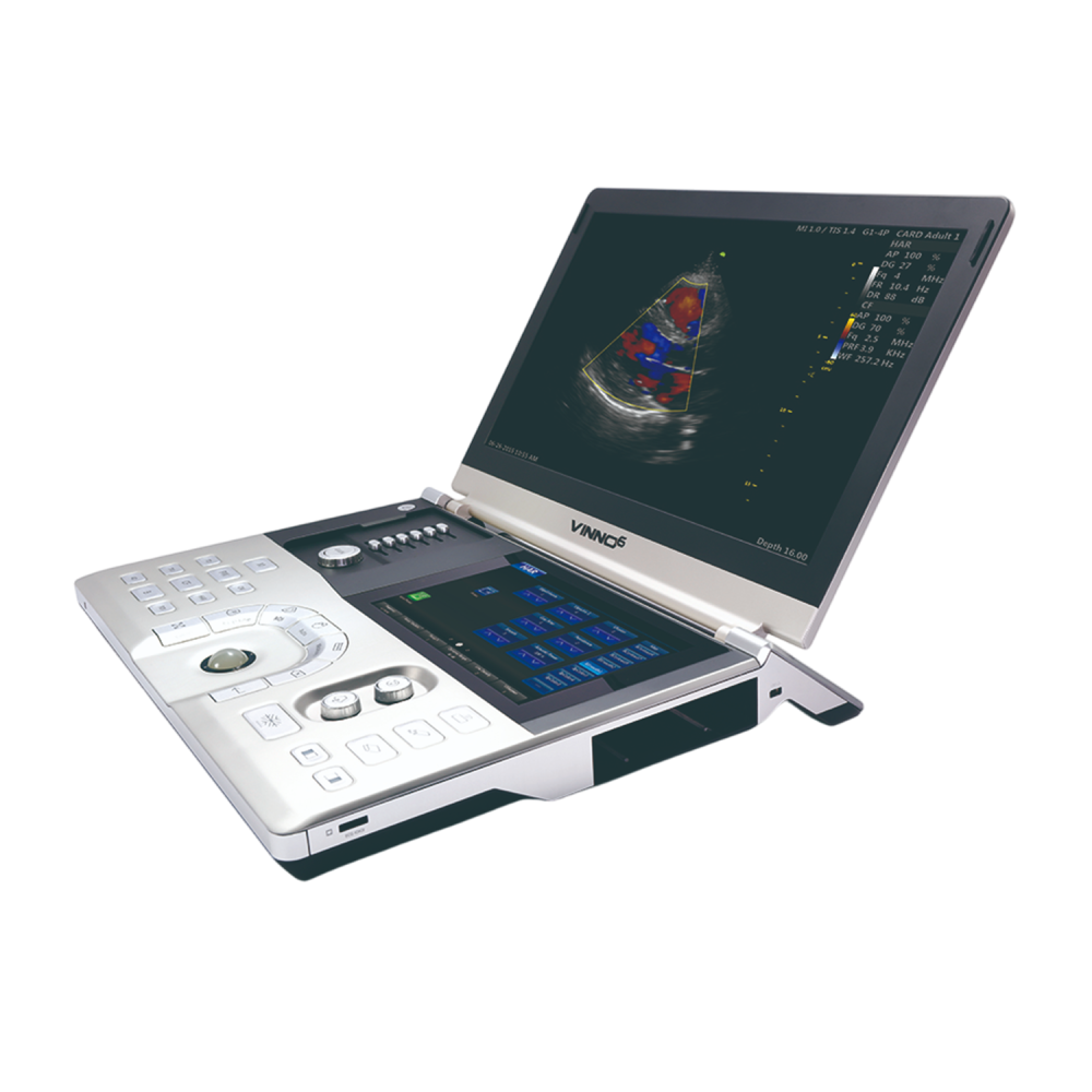 Портативный УЗИ аппарат VINNO 6