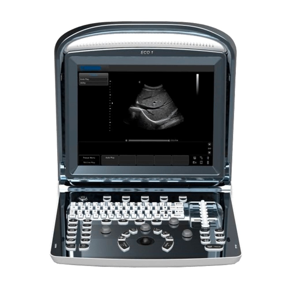 Портативный УЗИ аппарат Chison SonoTouch 10