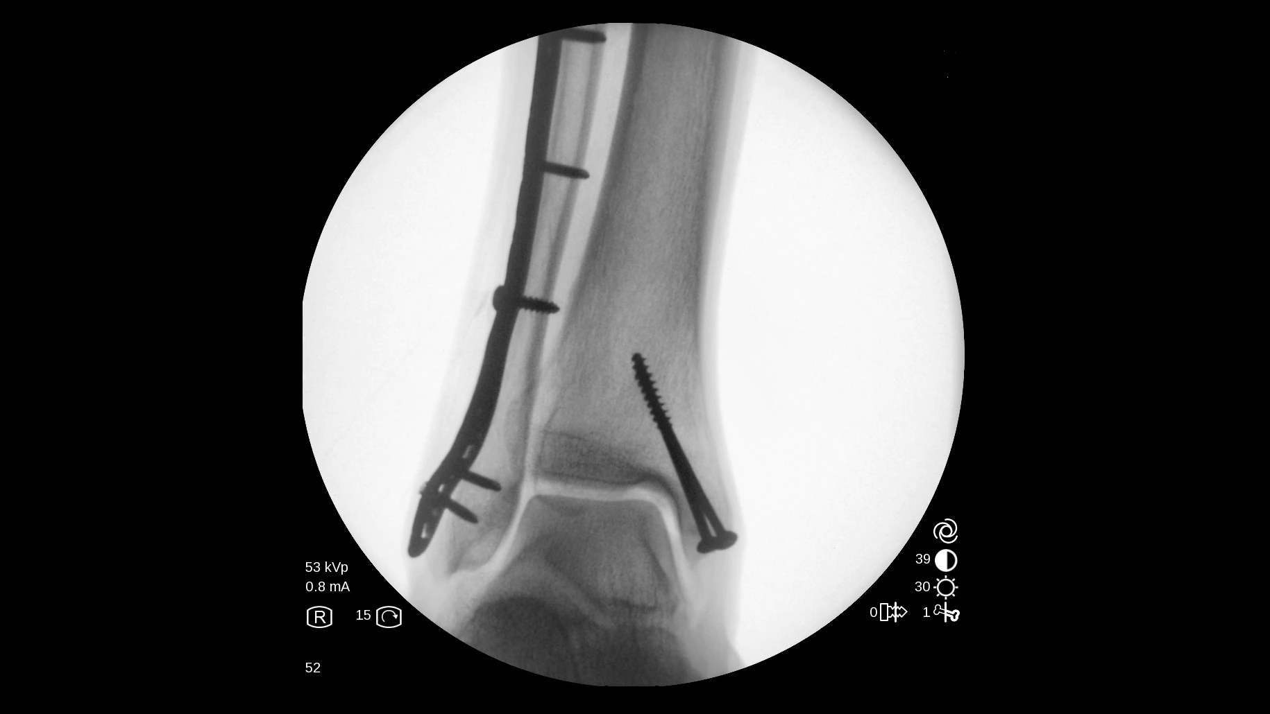 Мобильный рентгеновский аппарат с С-дугой GE OEC One
