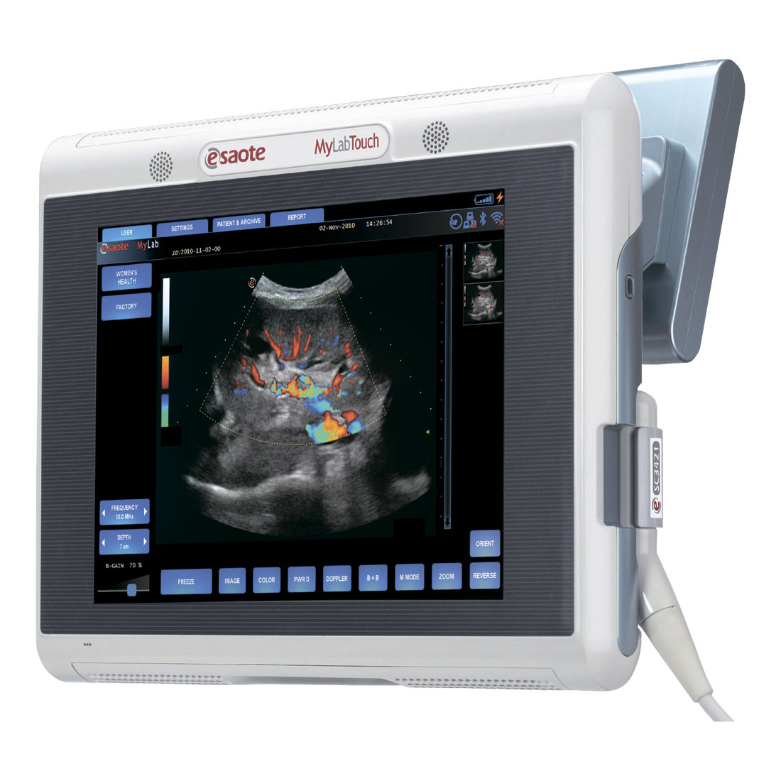 УЗИ аппарат Esaote MyLab One