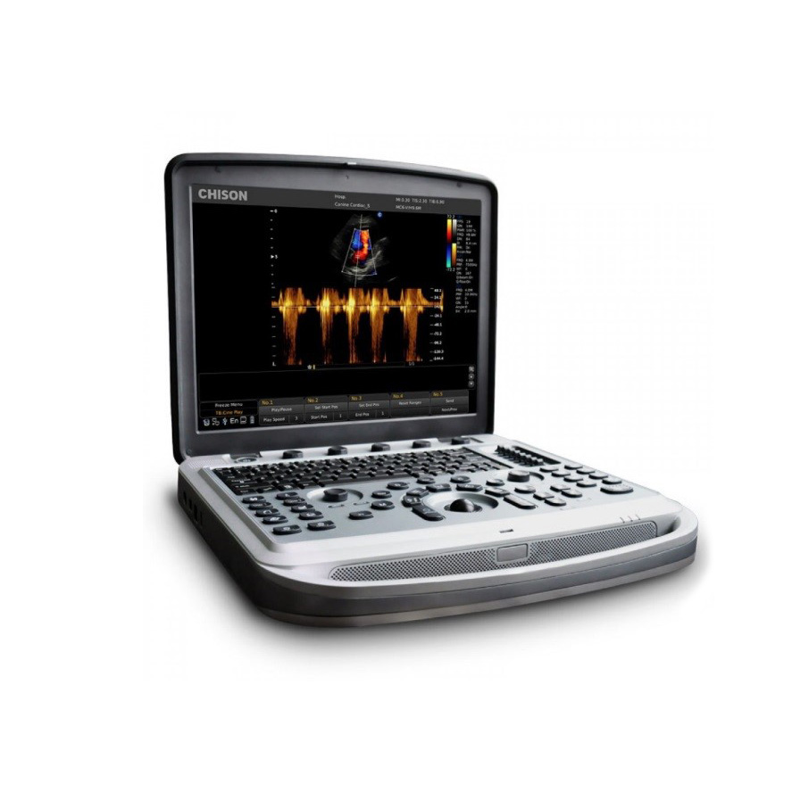 УЗИ аппарат Chison SonoTouch 80 (SonoBook 6)