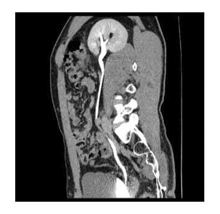 Компьютерный томограф Электрон «КТР» 16 срезов