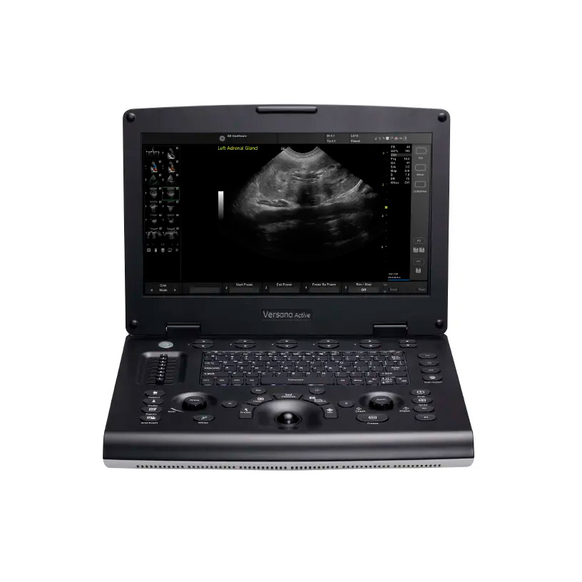 Ультразвуковая система GE Versana Active