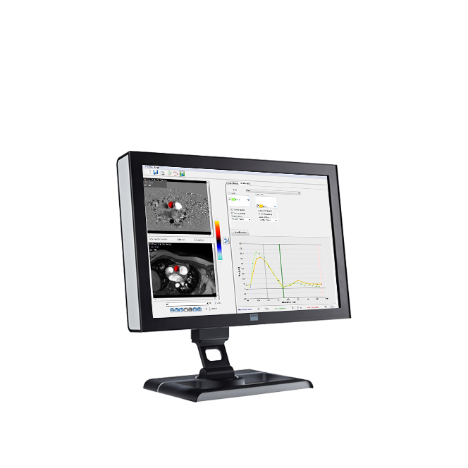 ПО для магнитно-резонансного анализа кровотока Esaote CAAS MR Flow