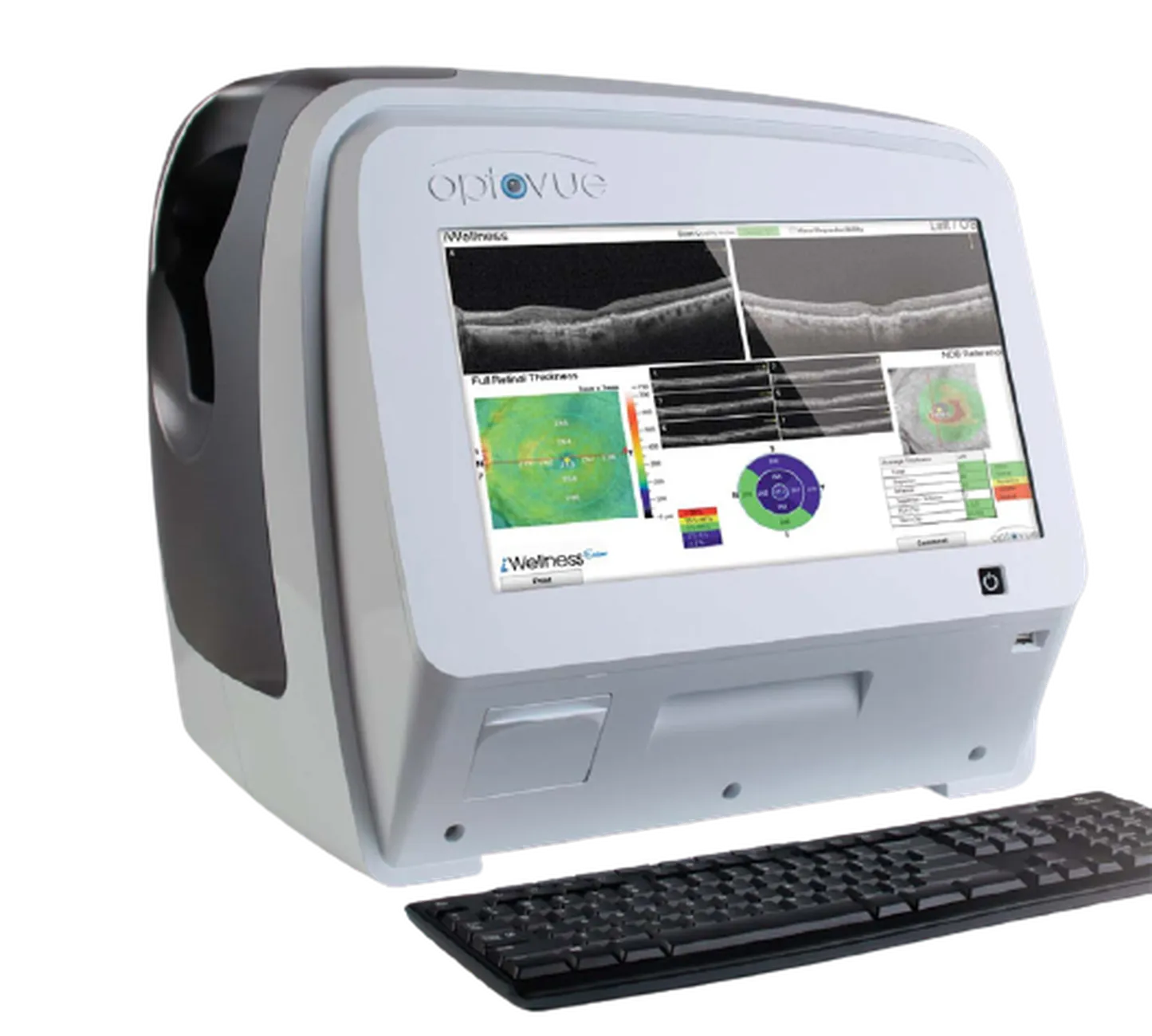 Optovue iScan