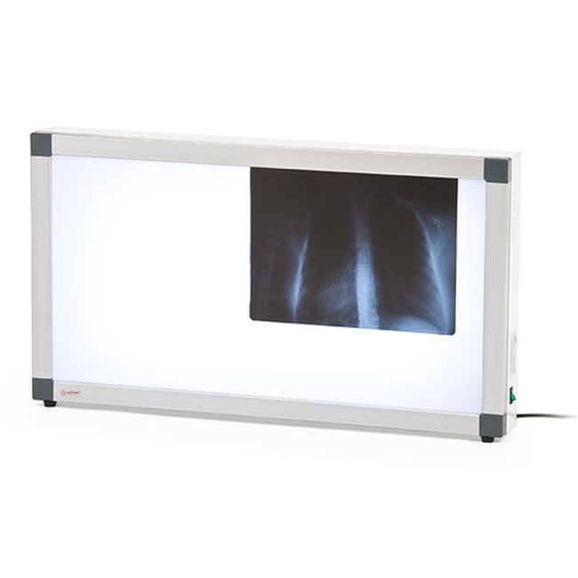 Негатоскоп общего назначения Армед 2-х кадровый