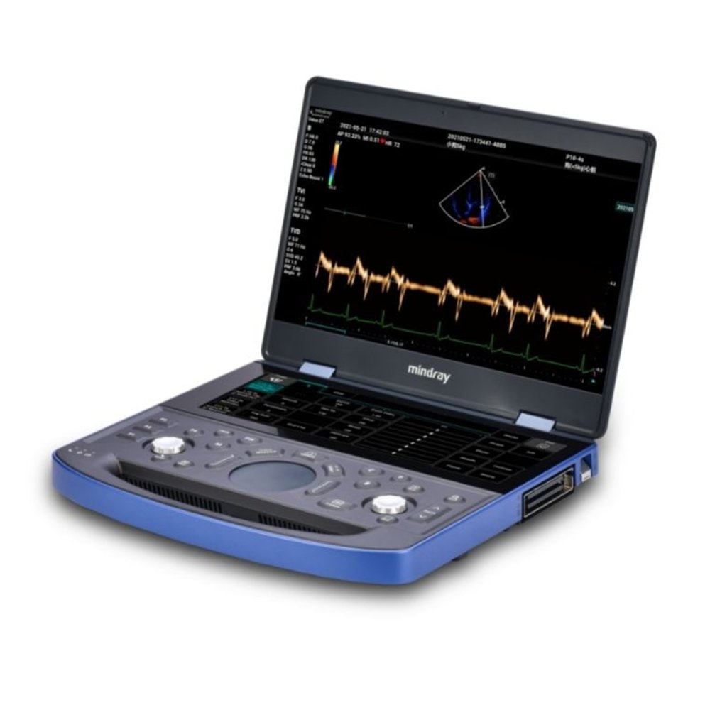 Ветеринарный УЗИ-сканер Mindray Vetus E7