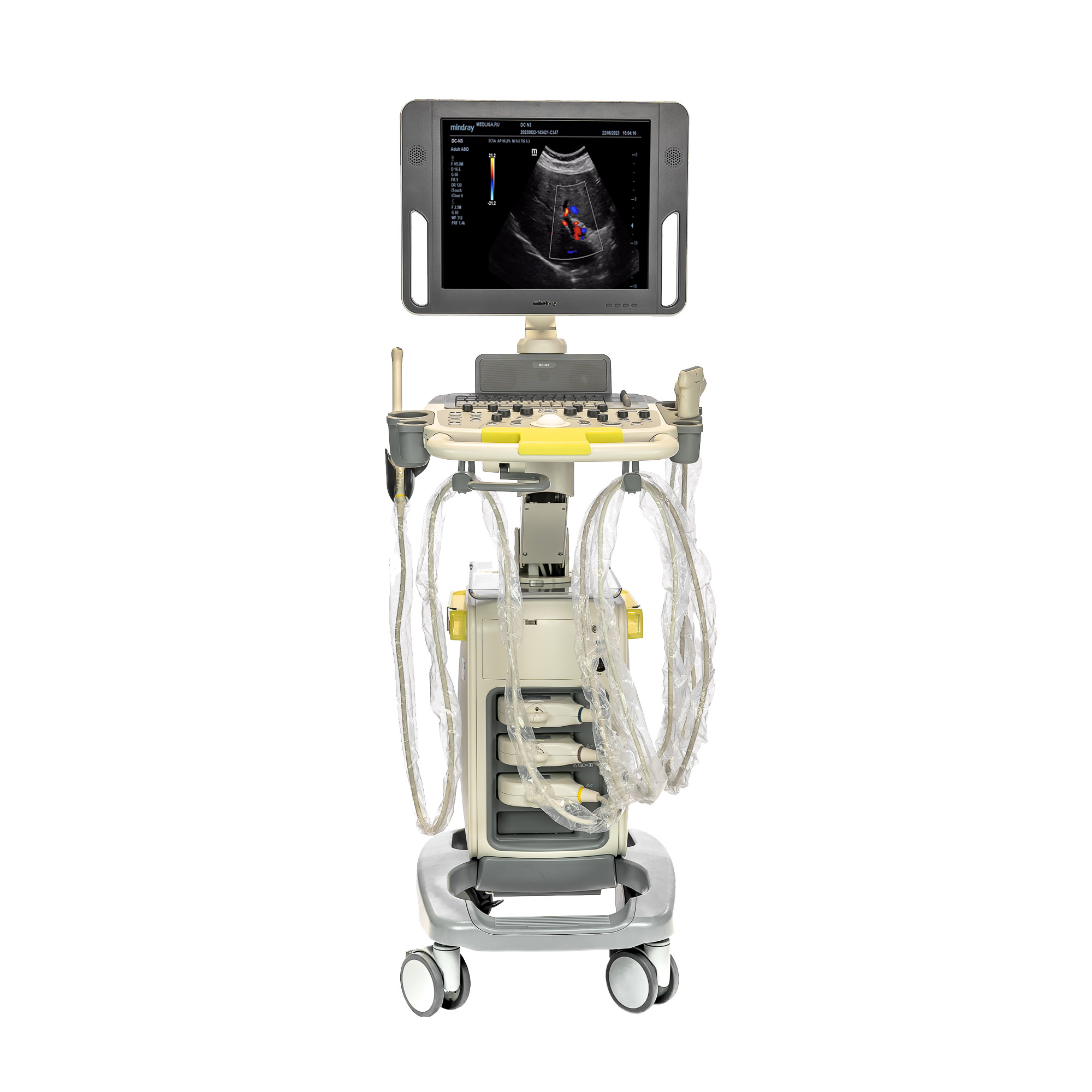 УЗИ аппарат Mindray DC-N3