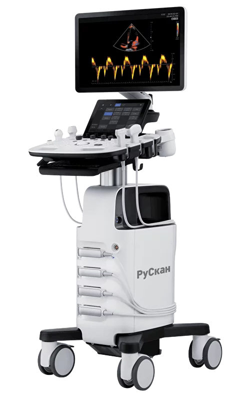 УЗИ аппарат РуСкан 60