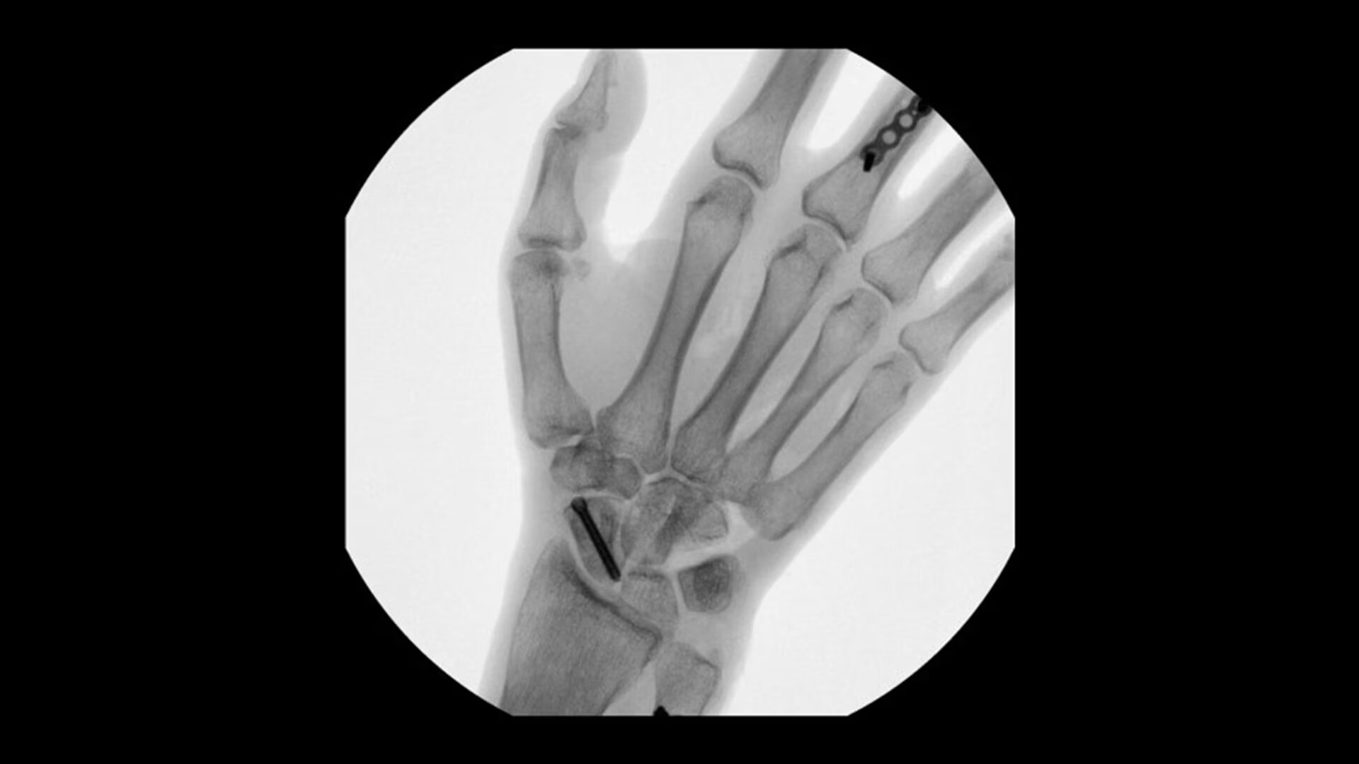 Мобильный рентгеновский аппарат с С-дугой GE OEC Elite MiniView