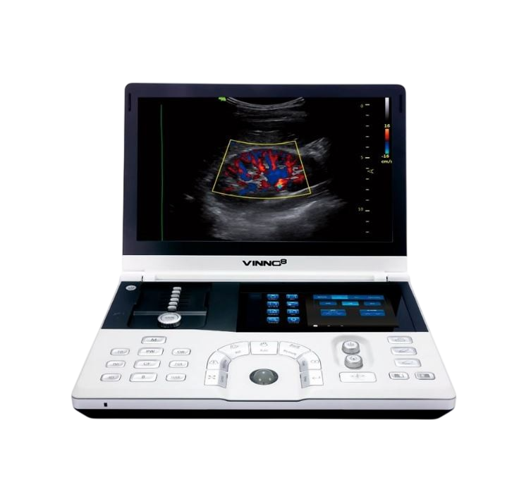 Портативный УЗИ аппарат VINNO 8