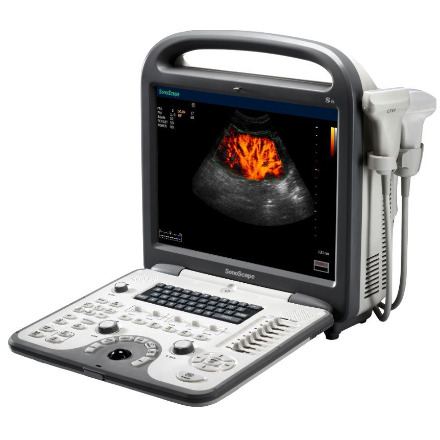 Ультразвуковой аппарат SonoScape S6Pro