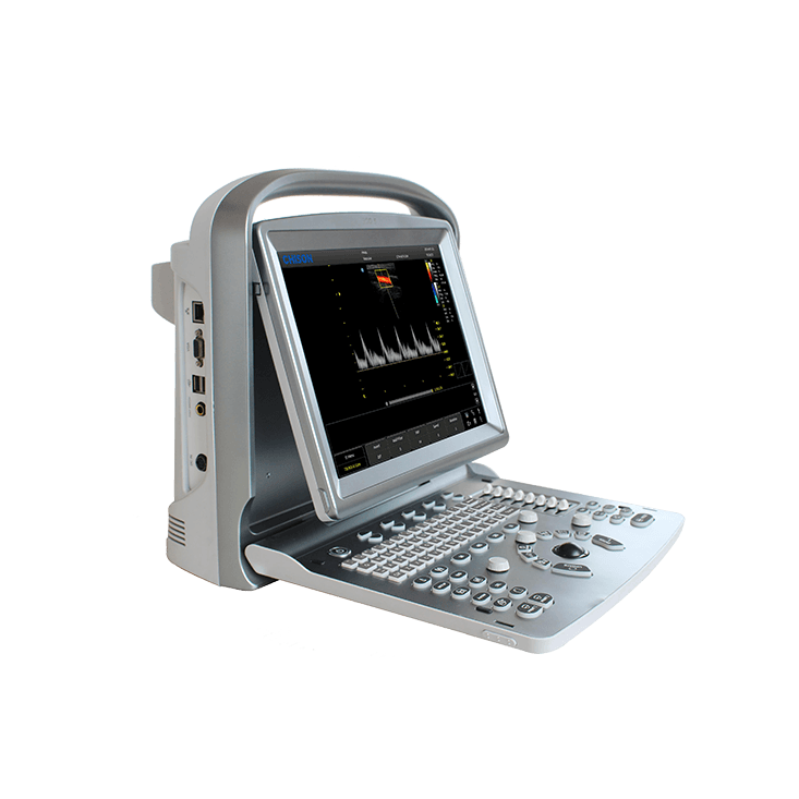 УЗИ аппарат CHISON ECO 5