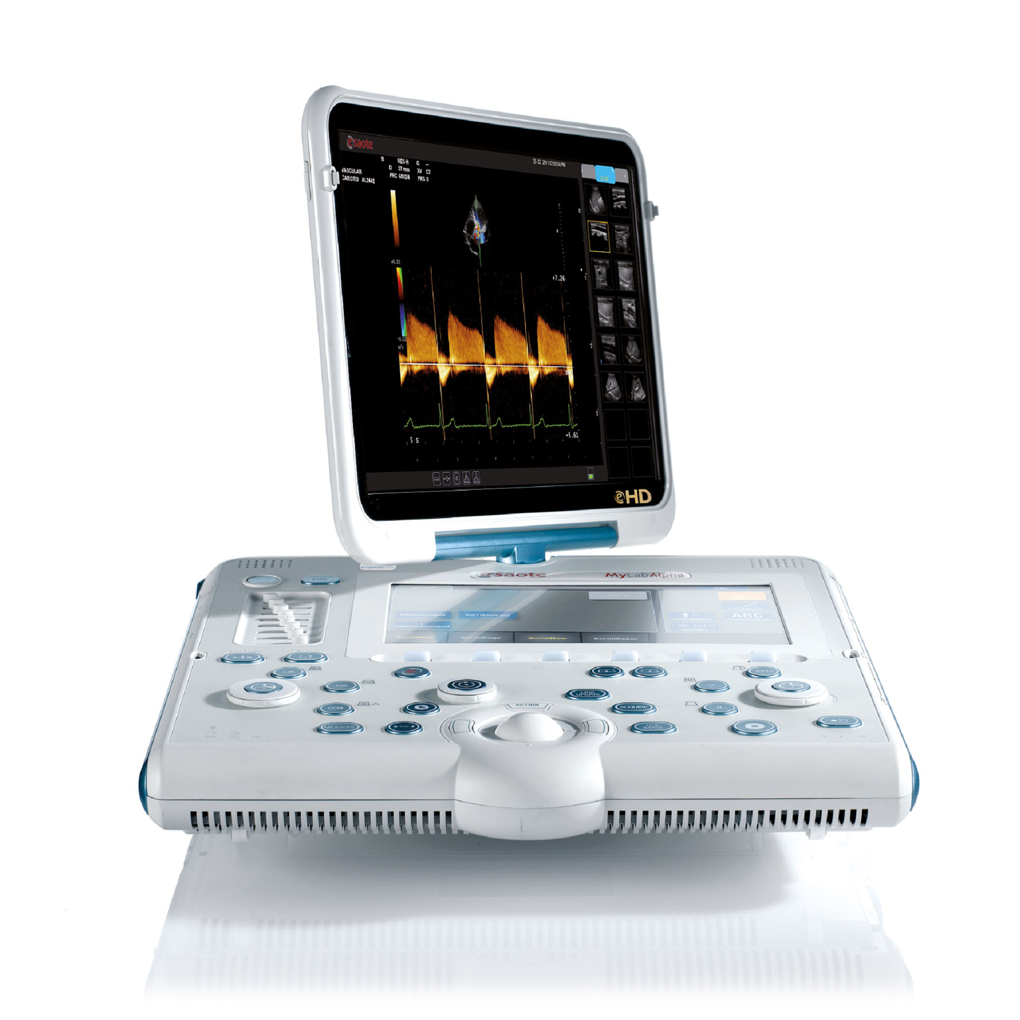 УЗИ аппарат Esaote MyLab Alpha