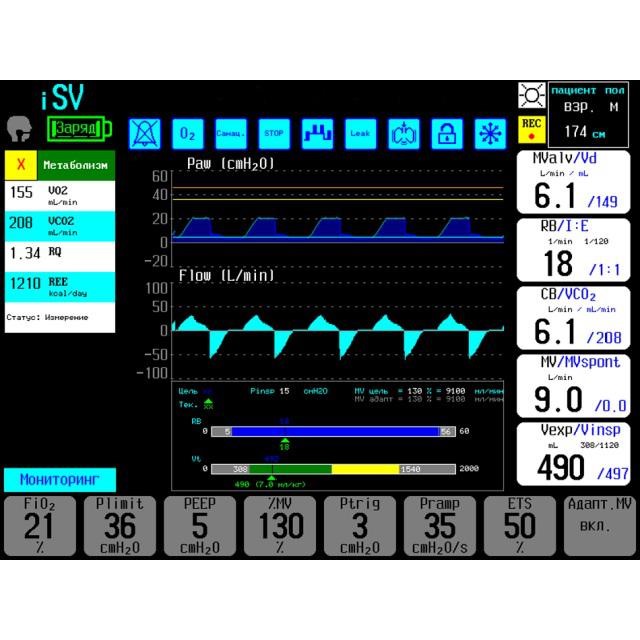 Аппарат ИВЛ Triton ZISLINE МV300 К1.22