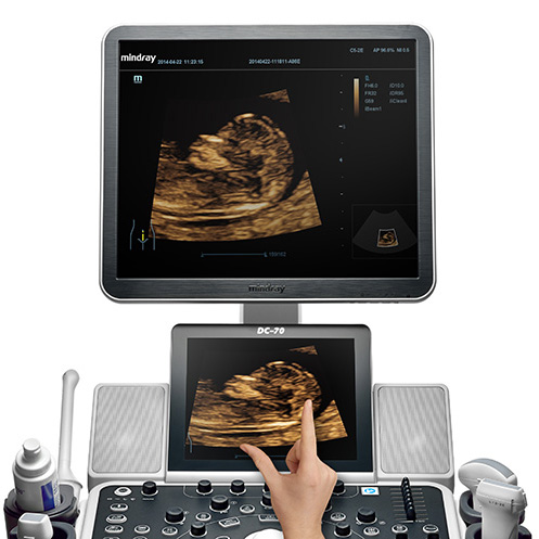 УЗИ аппарат Mindray DC-70S