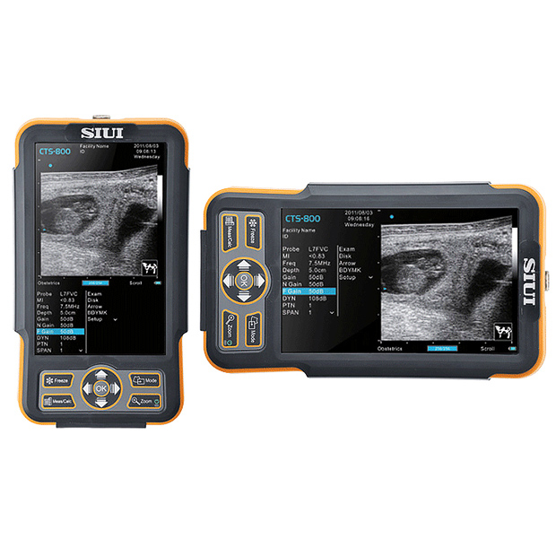 Ветеринарный УЗИ сканер SIUI CTS-800