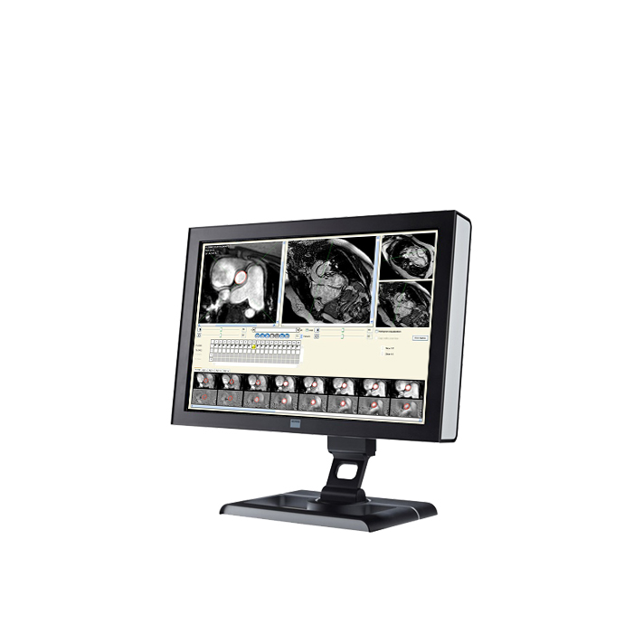 ПО для магнитно-резонансного анализа кровотока Esaote CAAS MR Flow