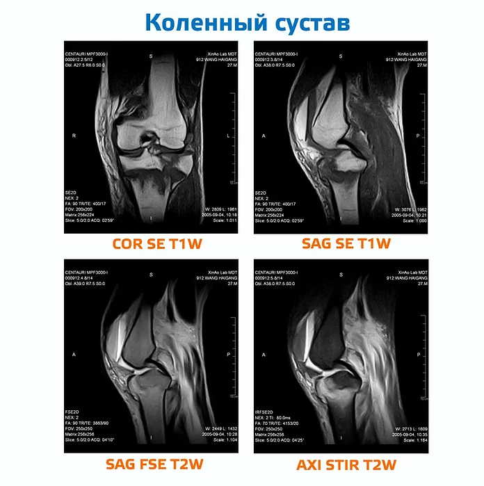 Магнитно-резонансный томограф МРТ-АМИКО300