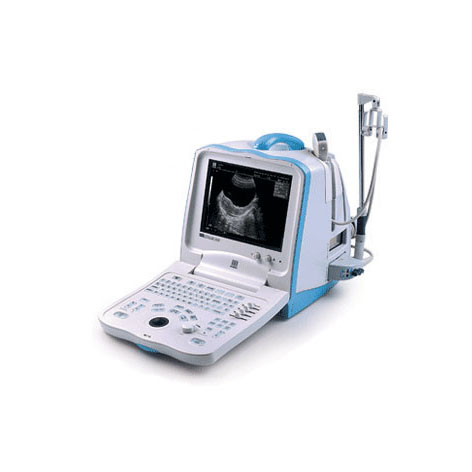 УЗИ аппарат Mindray DP 3300