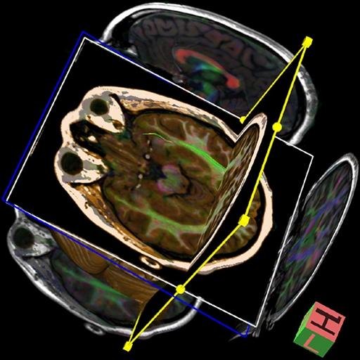 Катушка для головы Siemens Head 32
