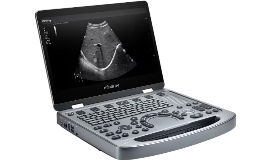 УЗИ аппарат Mindray MX5