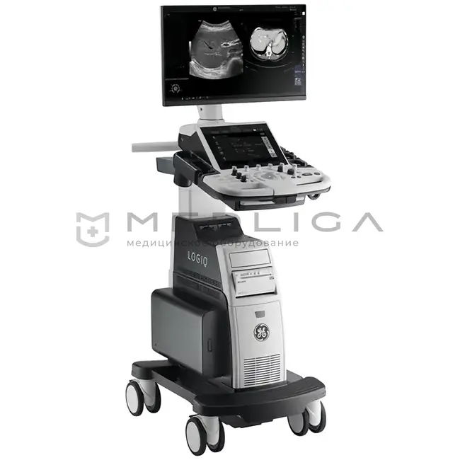 УЗИ аппарат GE LOGIQ P8
