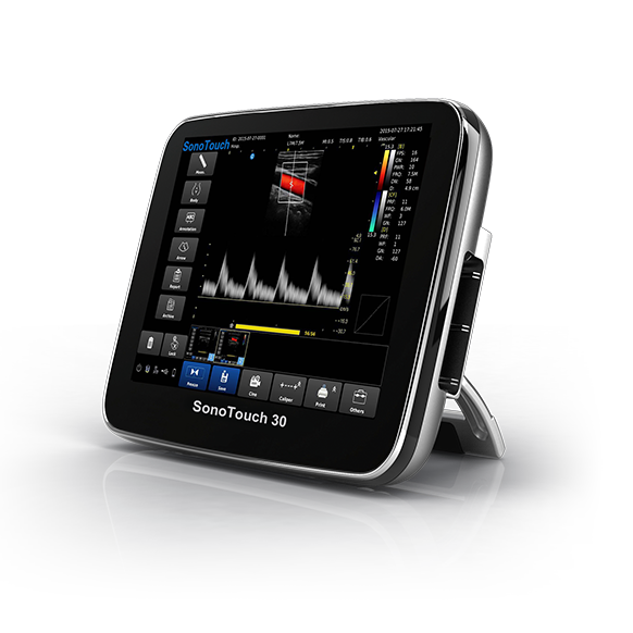 УЗИ аппарат CHISON SonoTouch 30 (ECO 3)