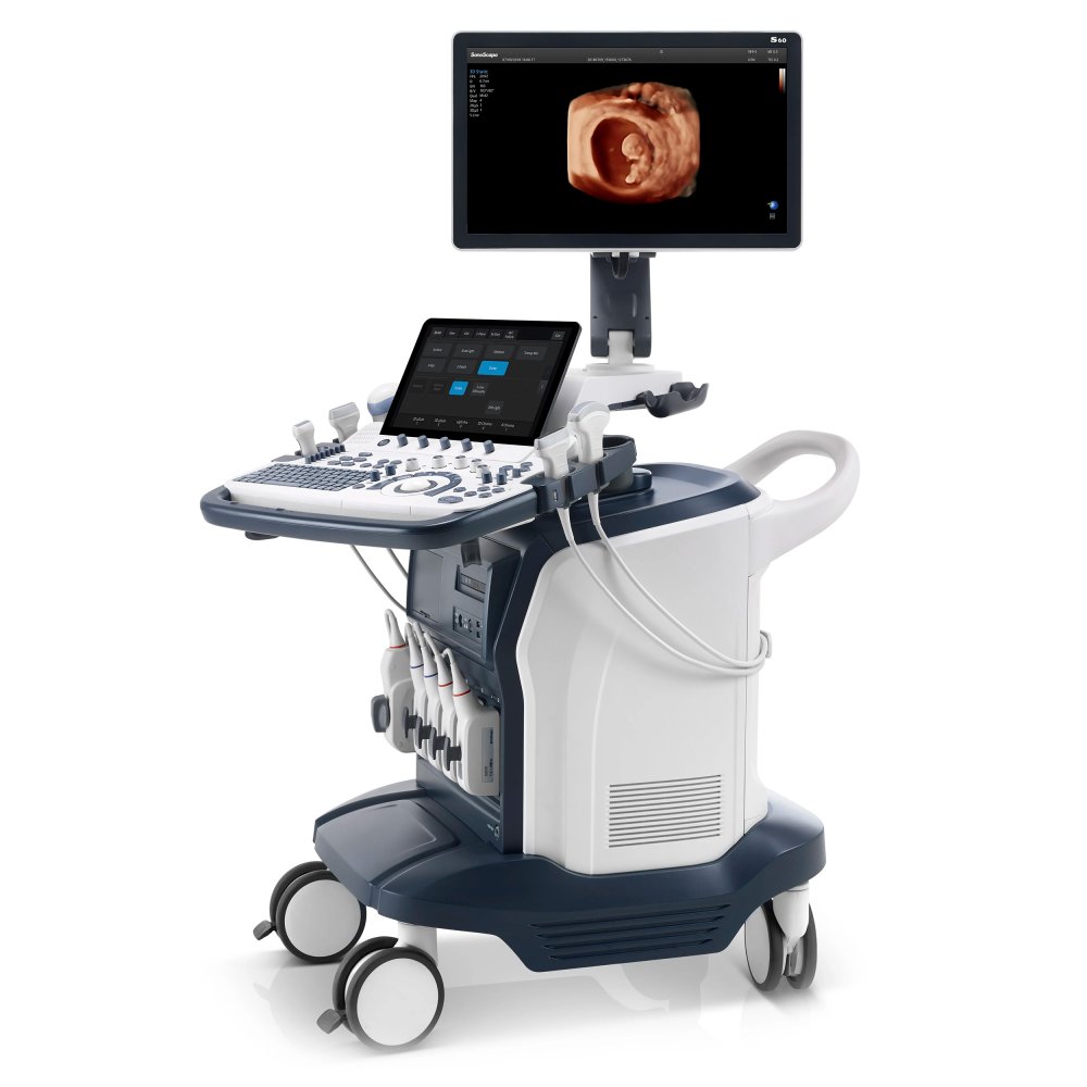 Ультразвуковой аппарат SonoScape S60