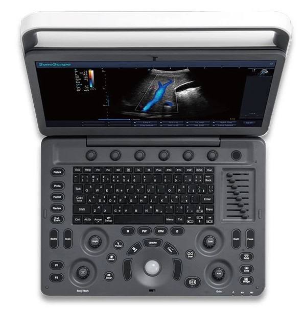 УЗИ аппарат SonoScape E3