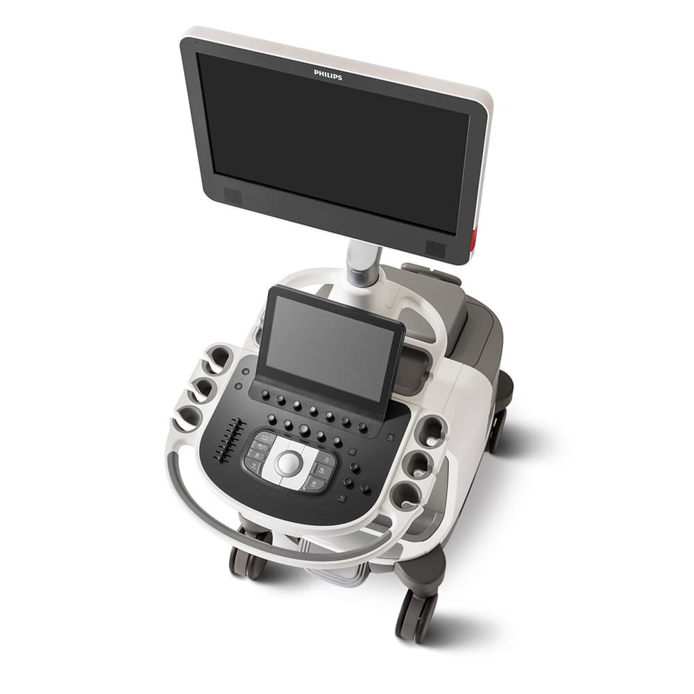 УЗИ аппарат Philips EPIQ CVx